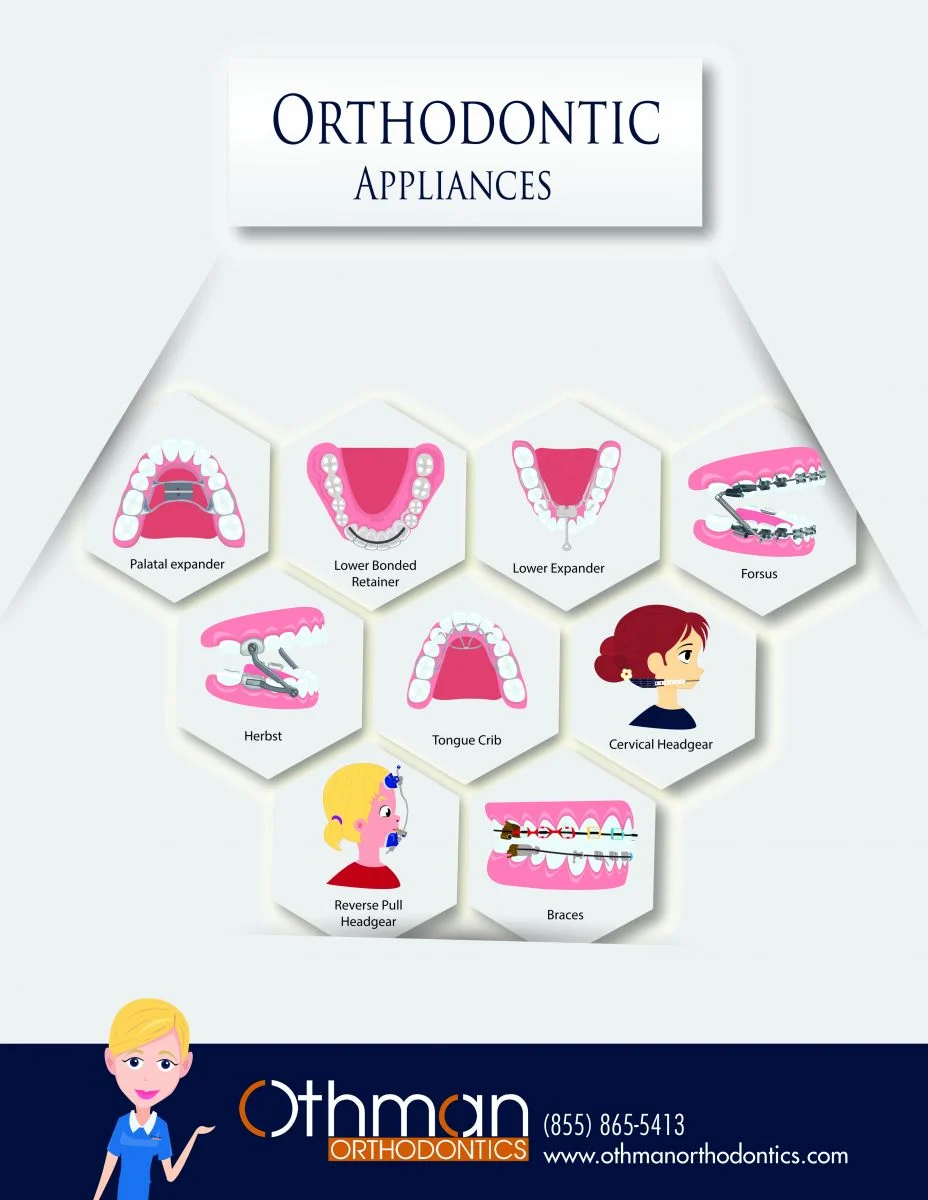 info-graphics Orthodontics appliances