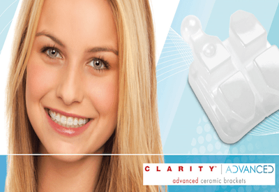 clarity-clear-braces