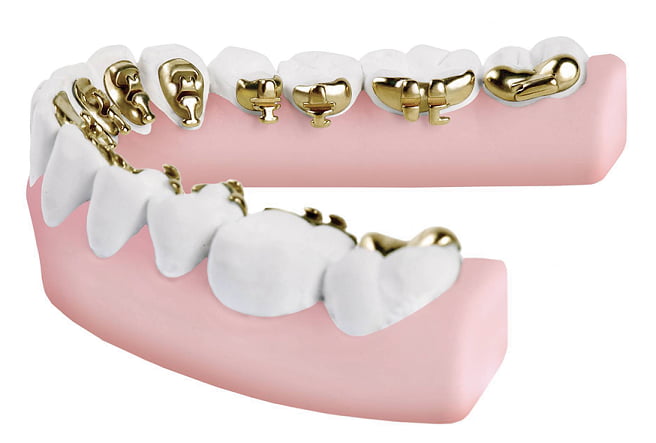 incognito-lingual-braces-othman-orthodontics